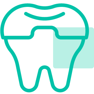 Dental Treatment 5 Root Canal Treatment