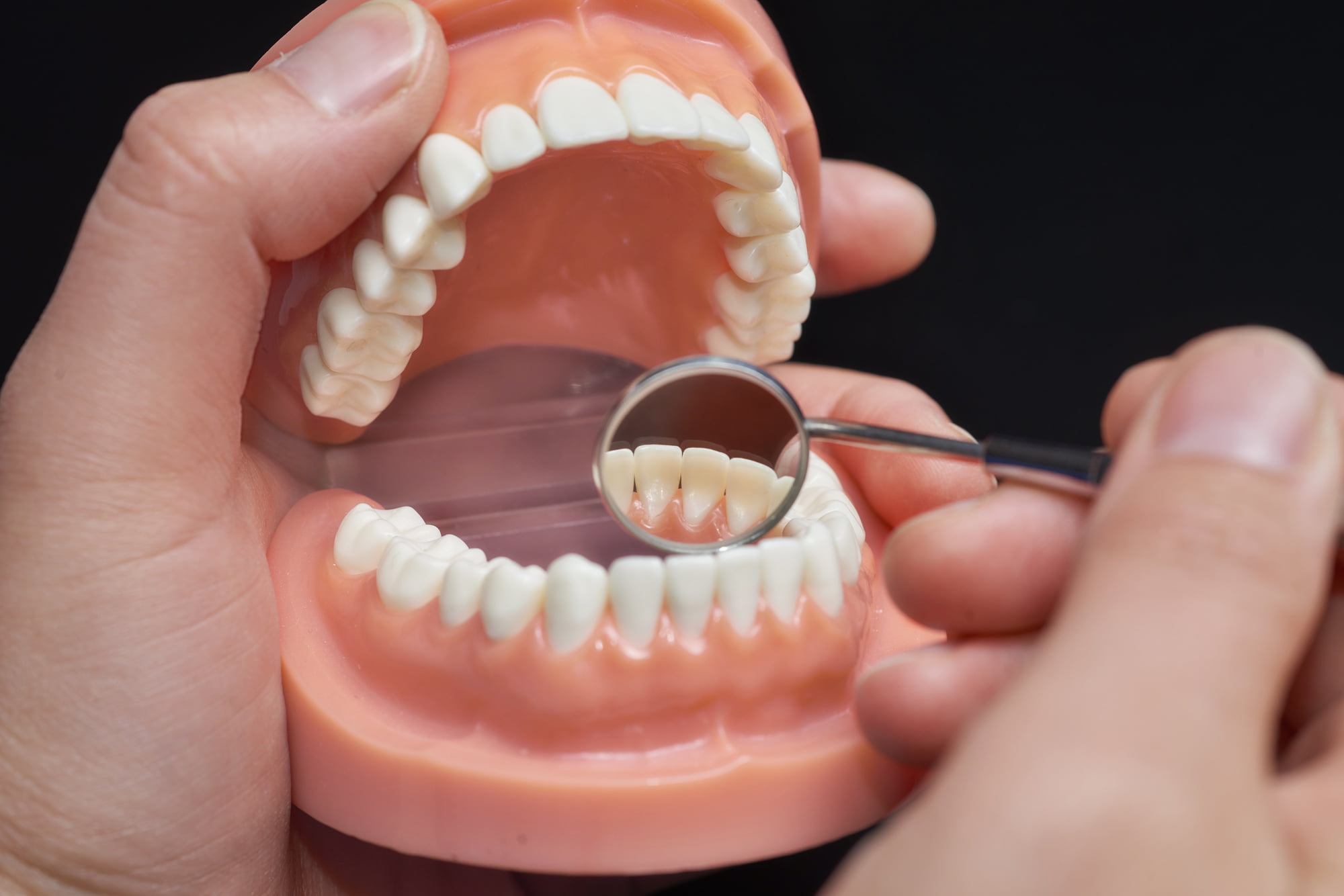 Crown and Bridge 7 Dental Crown vs Dental Bridge