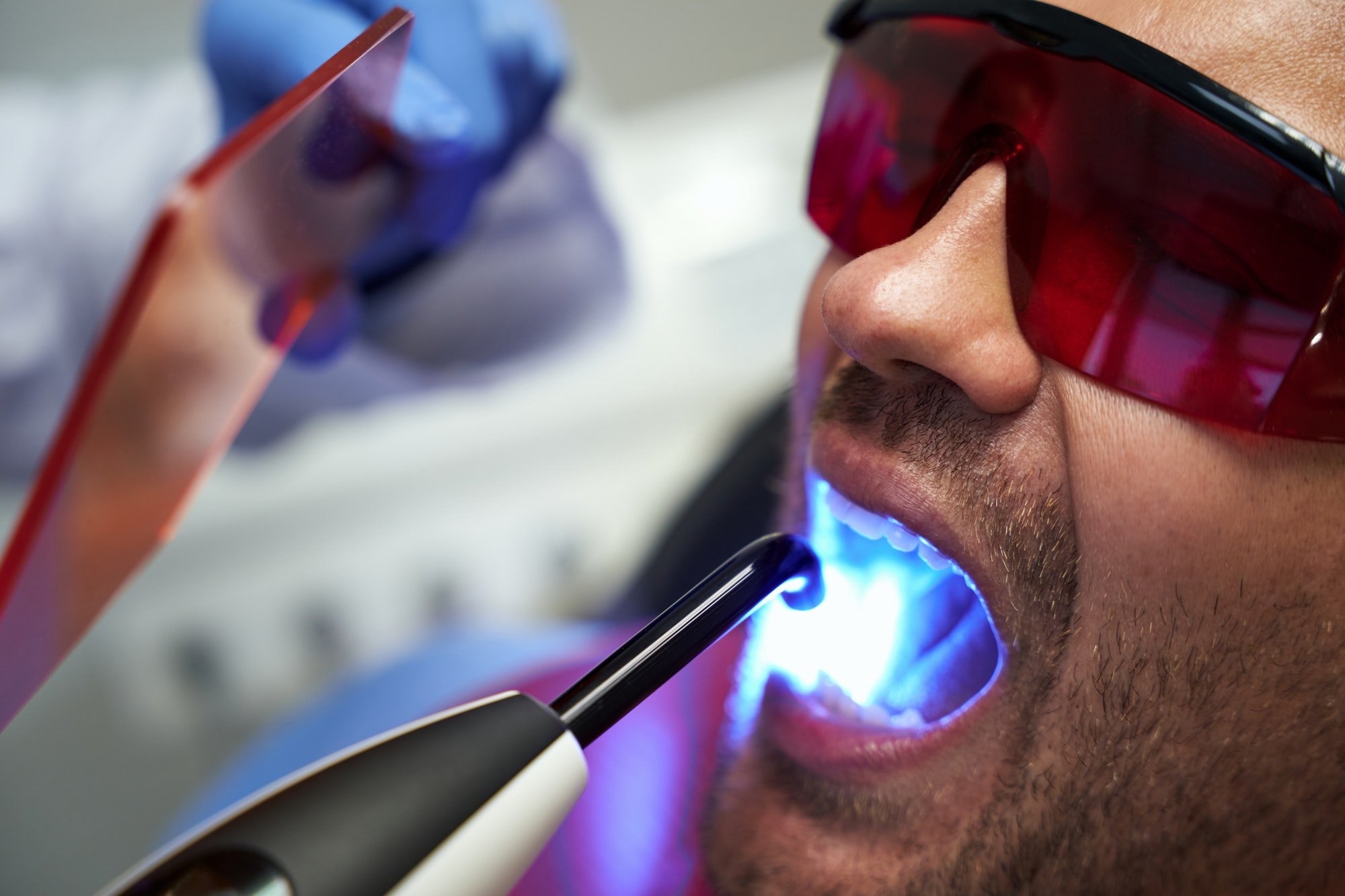Teeth Whitening 2 Patient in glasses receiving laser dental treatment at clinic