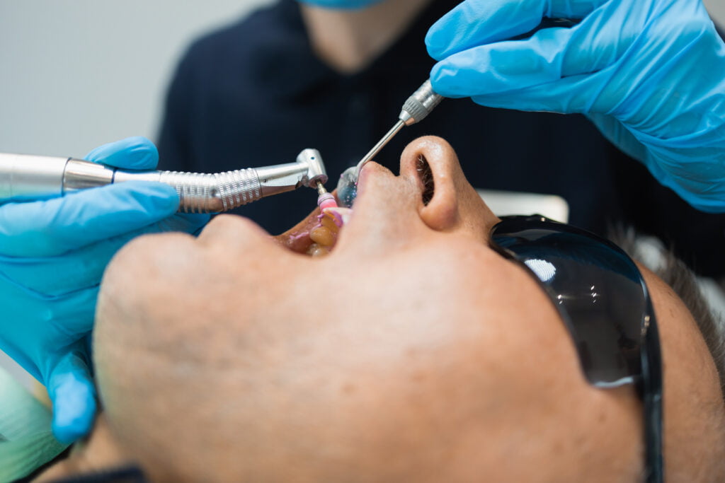 Why Teeth Scaling is Essential for Preventing Gum Disease 13 Teeth Scaling in Kepong, KL