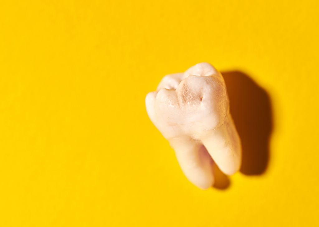 What Is an Impacted Wisdom Tooth & What Happens If You Don't Extract It? 4 What Is an Impacted Wisdom Tooth & Why You Shouldn’t Ignore It