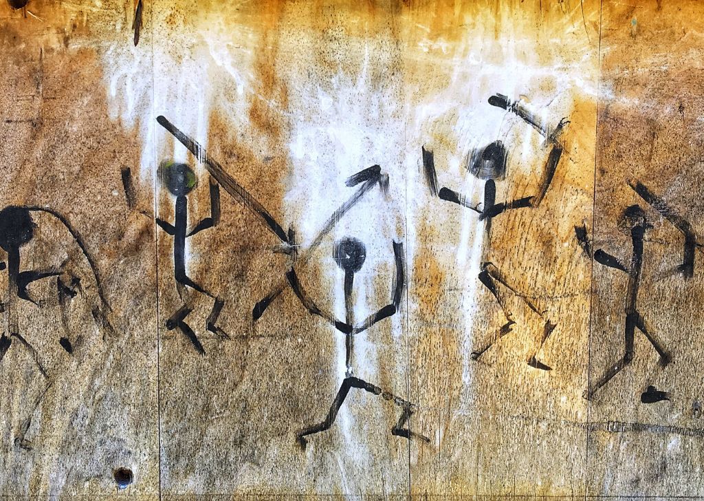 What Is an Impacted Wisdom Tooth & What Happens If You Don't Extract It? 2 What Is an Impacted Wisdom Tooth & Why You Shouldn’t Ignore It