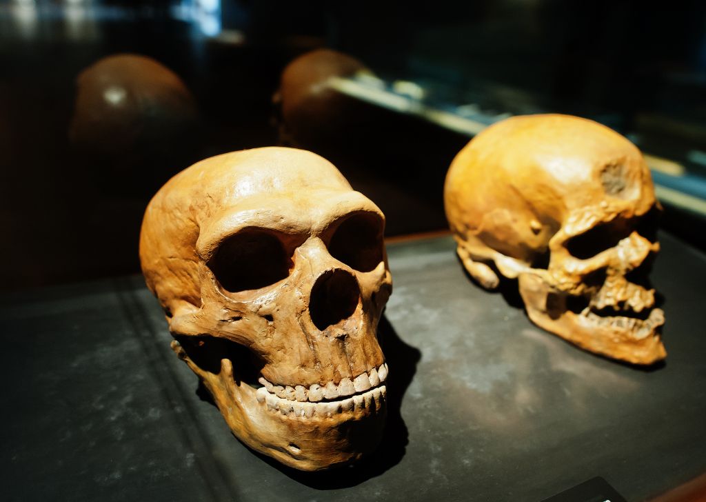 What Is an Impacted Wisdom Tooth & What Happens If You Don't Extract It? 3 What Is an Impacted Wisdom Tooth & Why You Shouldn’t Ignore It