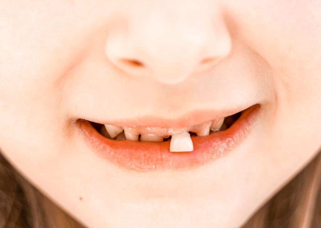 Do Tooth Fillings Hurt For Kids? Here's What You Need to Know