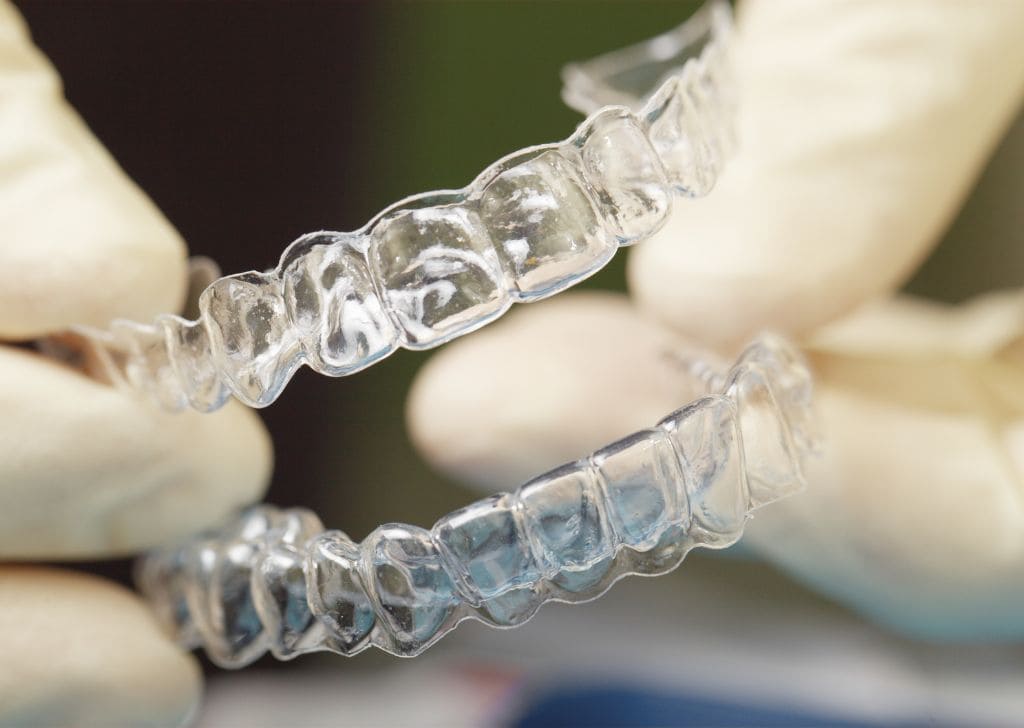 Is It Time To Get Braces For Your Kids? Look Out For These 7 Signs 3 Traditional Metal Braces Traditional metal braces are the most common type of orthodontic treatment. They consist of metal brackets that are bonded to each tooth and connected with an archwire. Small rubber bands (ligatures) are used to hold the wire in place. The braces are periodically adjusted by the dentist to gradually align the teeth.