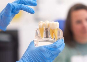 Can Old People Still Get Dental Implants? Here's What We Have to Say 1 dental implants are safe for seniors. Learn about success rates, risks, recovery tips, and implant options for elderly patients at Fresh Dental Kepong.