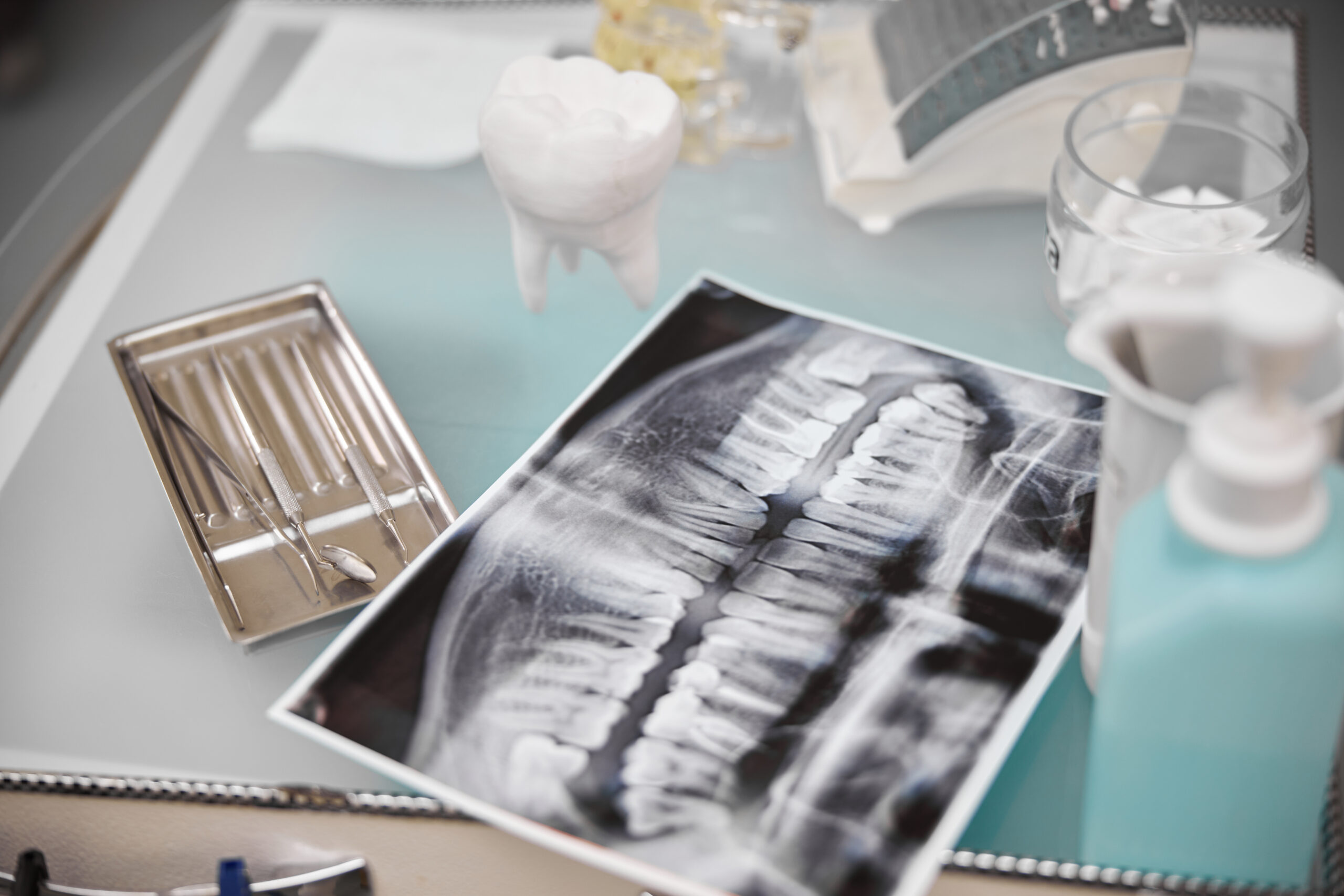 When Is the Best Time to Get Braces? 4 Tabletop set up with dental tools and props