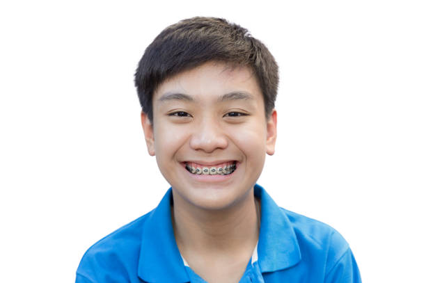 Young man beautiful smile with teeth brace dental on isolate background.