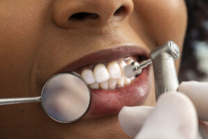 dentist polishing teeth of patient in dental clinic