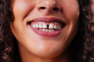 female has teeth gap