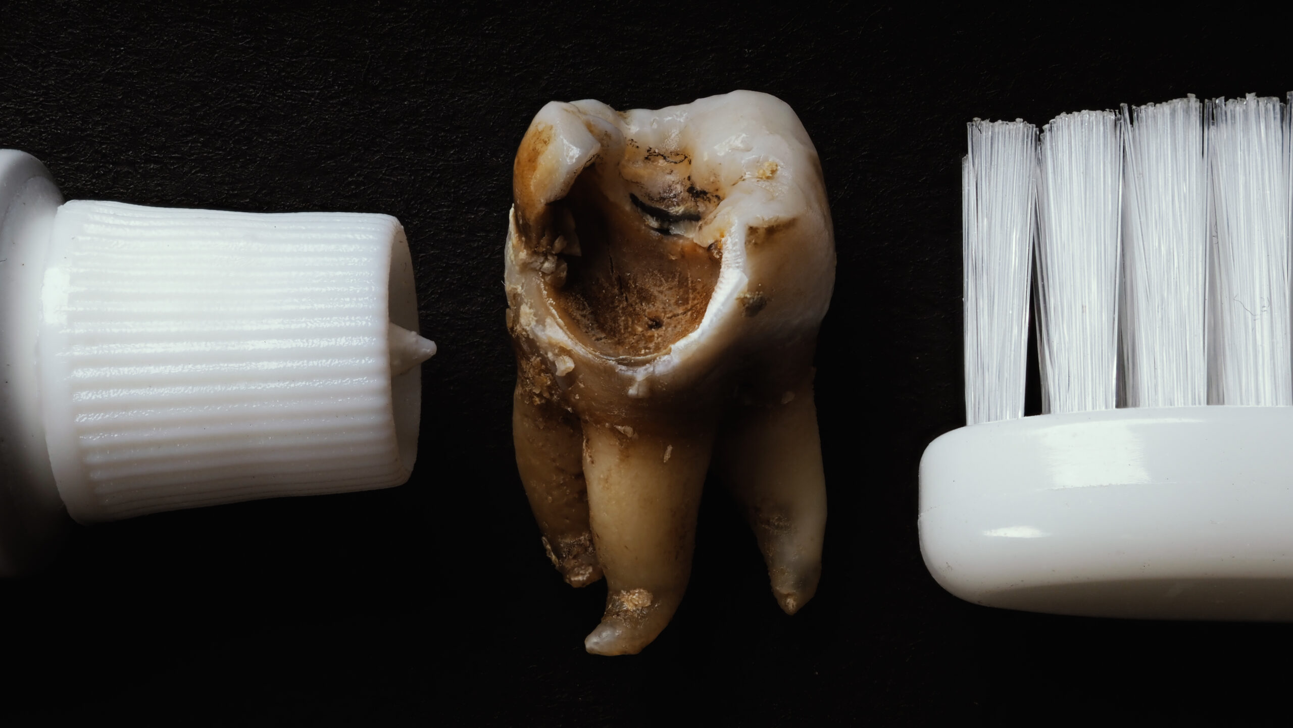 How to Clean Dental Crowns Properly and Keep Them Lasting Longer 3 dirty tooth