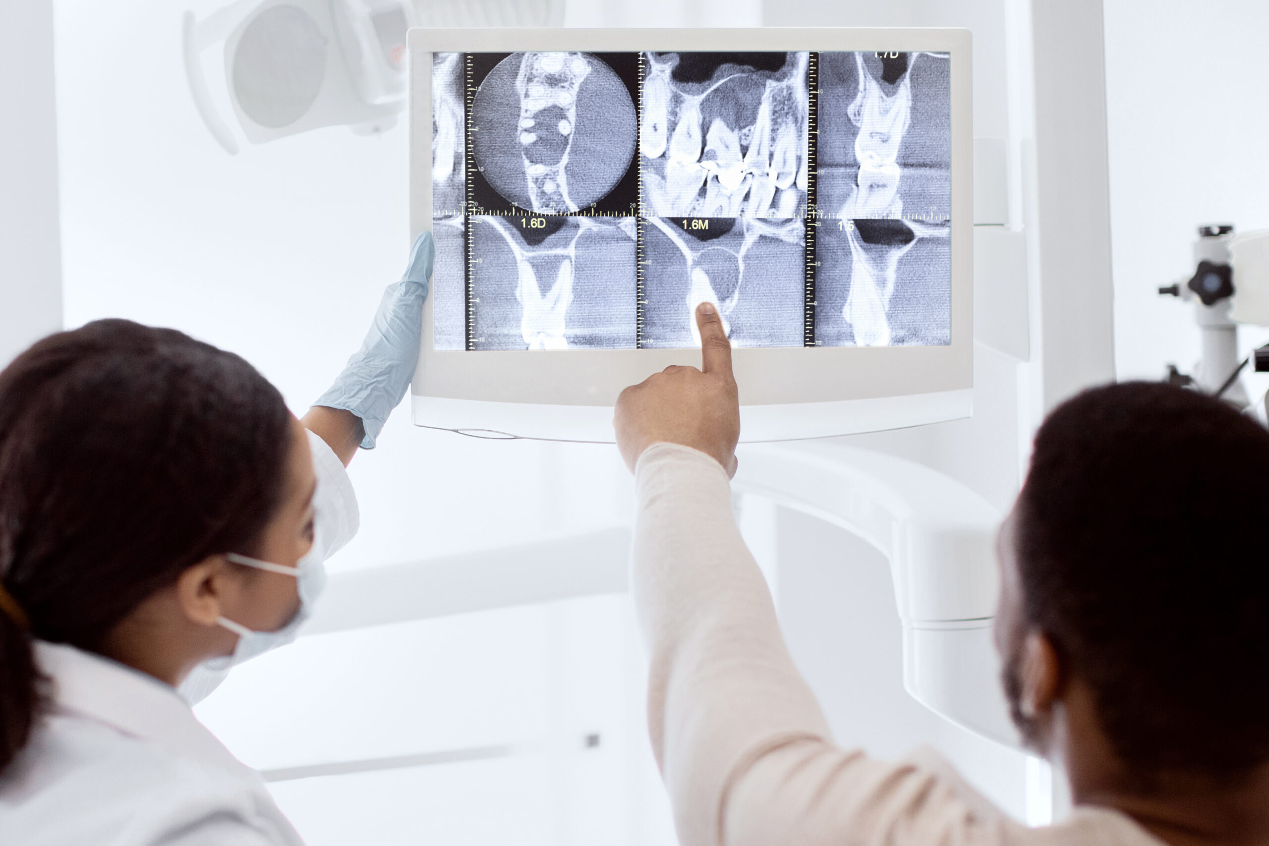 bone graft on teeth